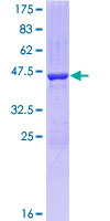 12.5% SDS-PAGE Stained with Coomassie Blue.